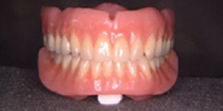 Example of dentures